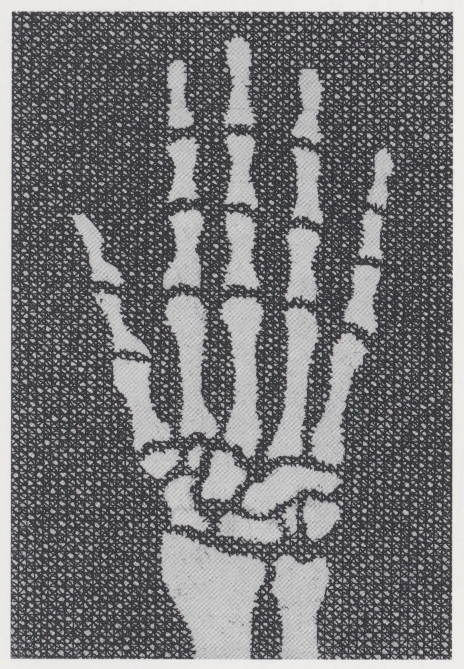 Skelett einer Hand