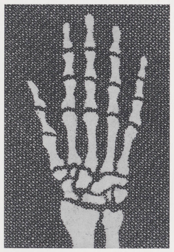 Skelett einer Hand